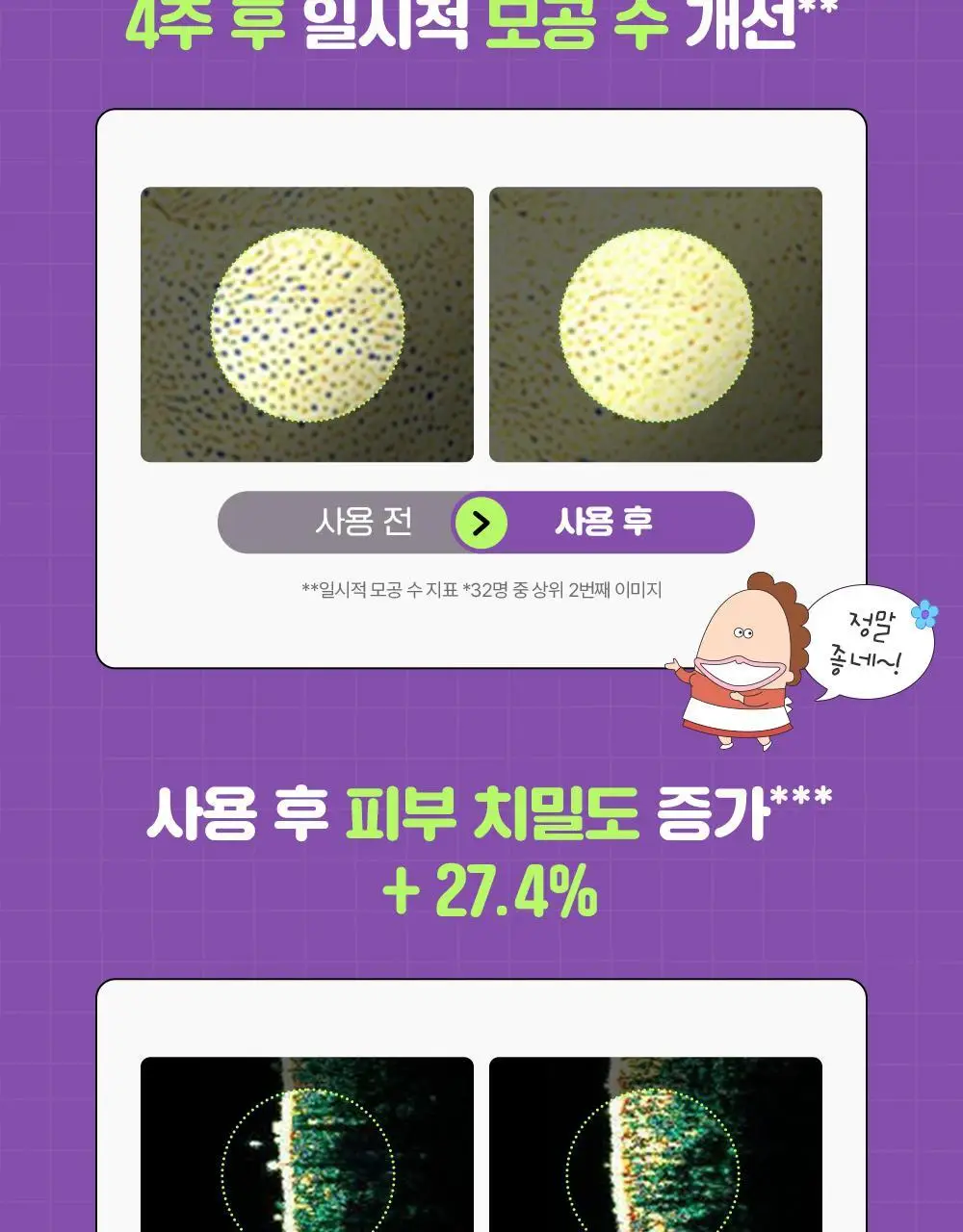 [90ml대용량]차앤박 더마앤서 액티브 부스트 PDRN 앰플 30ml+60ml 리필+대형스티커 (아따맘마 콜라보) 상세페이지 16
